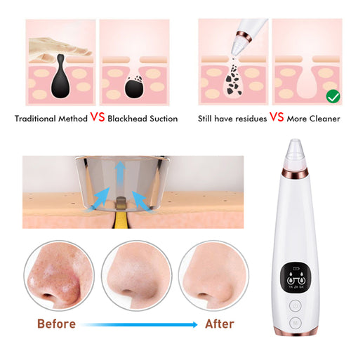 Facial Microcrystalline Blackhead Removal Beauty Tool